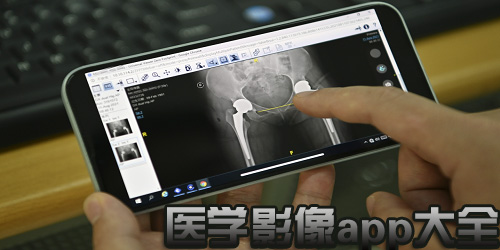 医学影像app