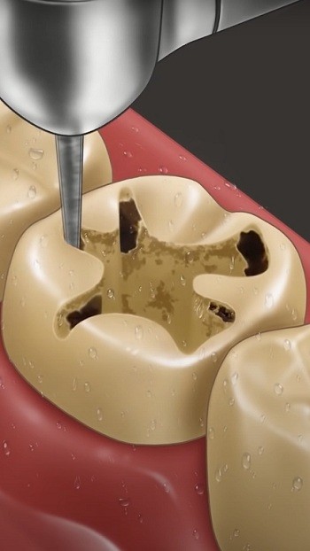 牙医硕士游戏 牙医硕士手游下载